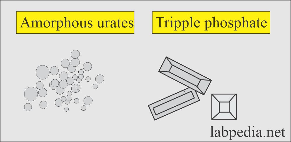 Amorphous urates and triple phosphate
