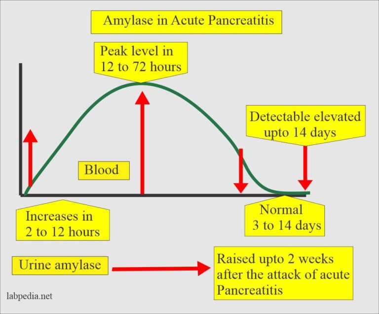 Amylase Serum and Acute Pancreatitis Diagnosis
