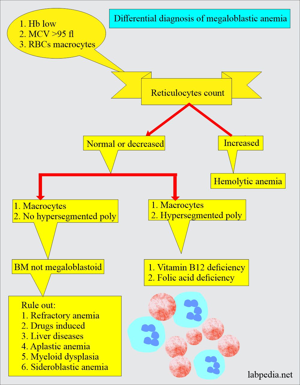 megaloblastic anemia peripheral smear