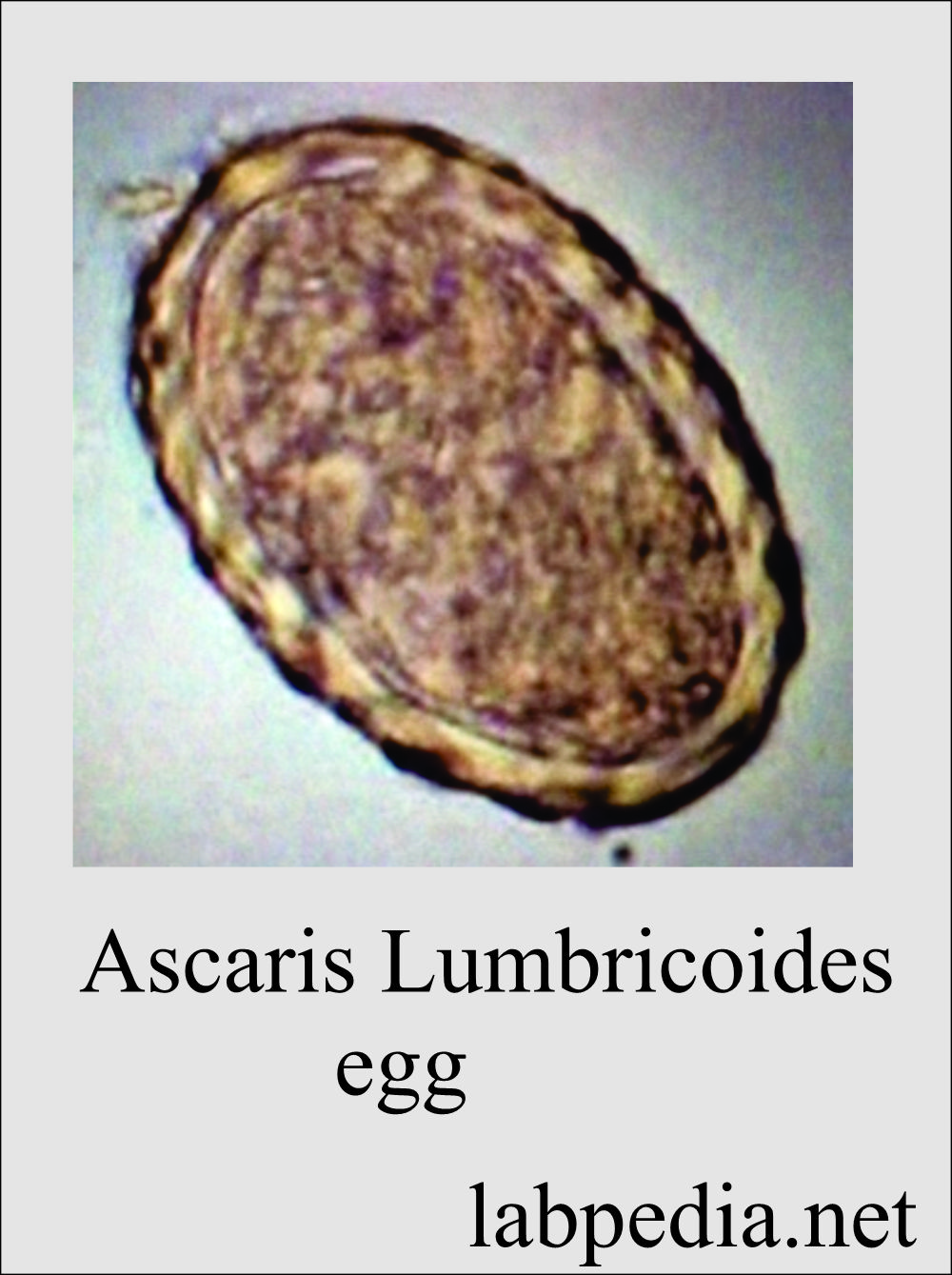 Common parasites: Ascaris lumbricoides egg