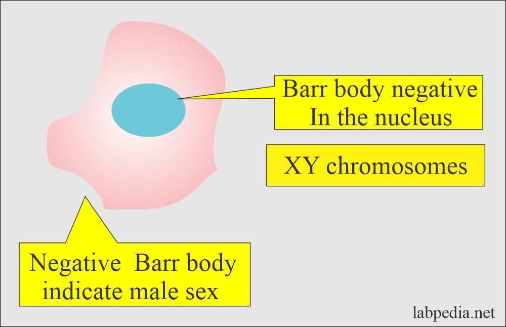Barr body negative indicate Male