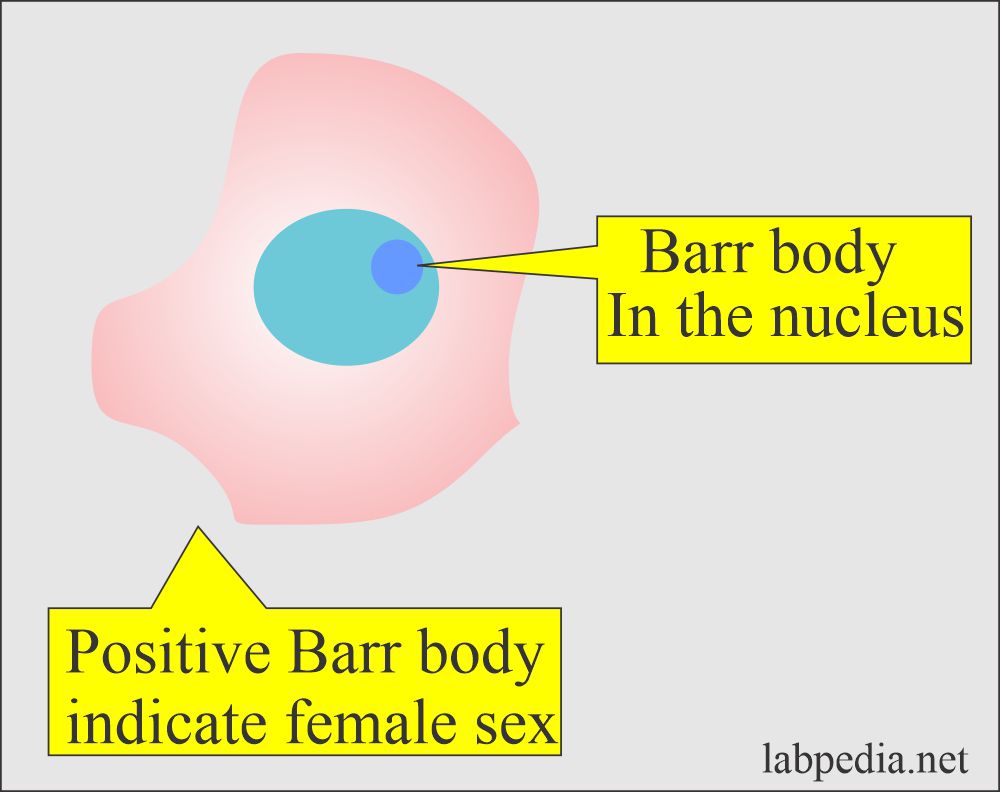 Barr body positive in the female