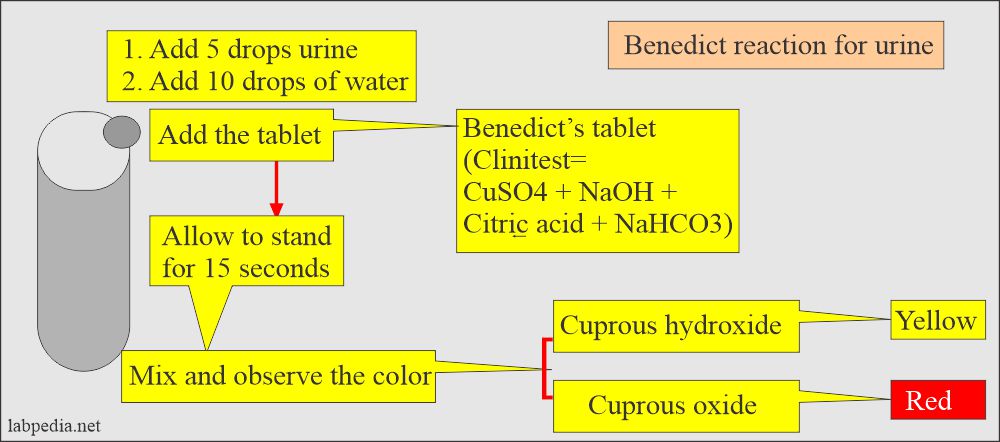 Glucose in Urine (Glucosuria): Benedict reaction