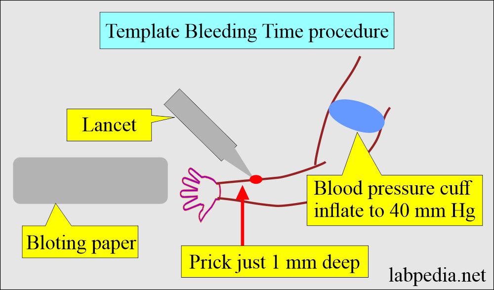 Template bleeding time procedure