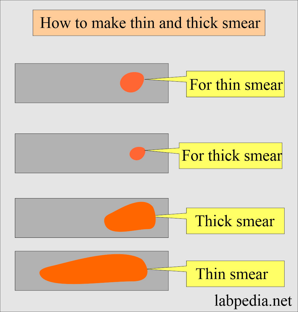 How to make blood smear thin, and thick