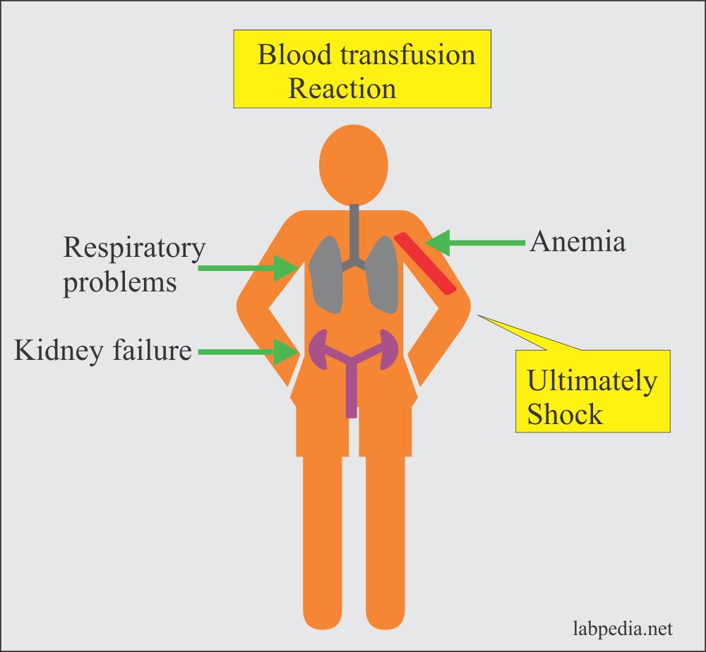 Blood Banking Part 4 Blood Transfusion Reactions In Donor And Recipient Adverse Reactions Due To Blood And Blood Products Treatment Of Reactions Labpedia Net