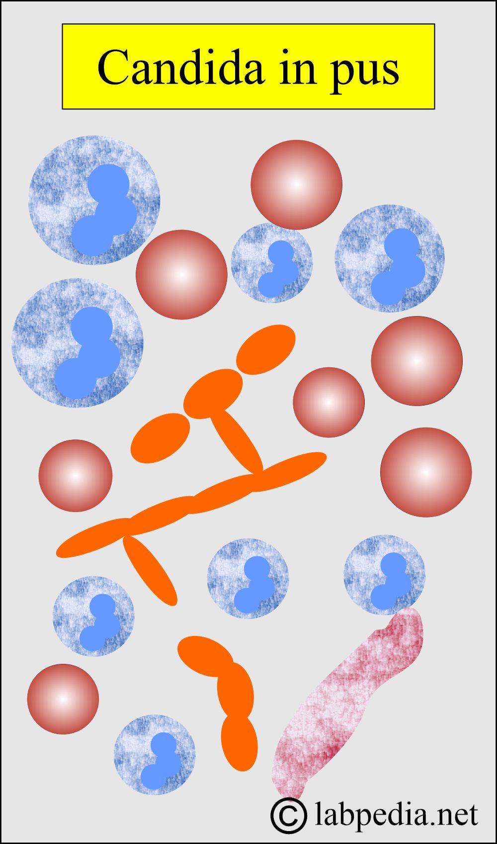 Candida in pus