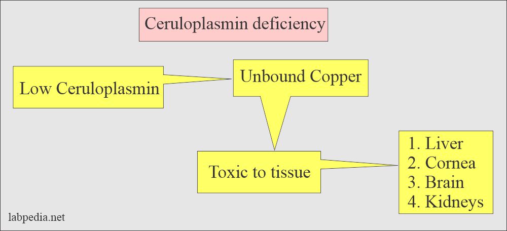 Ceruloplasmin deficiency