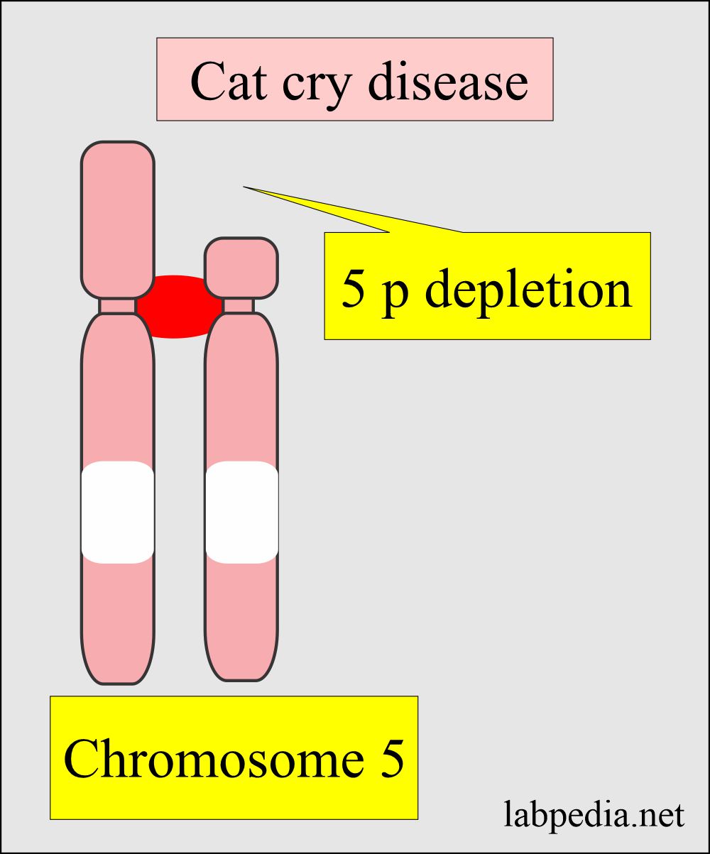 Cat cry disease 