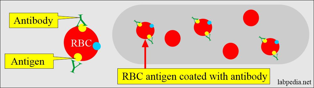 RBC coated with Antibody in direct Coombs' test
