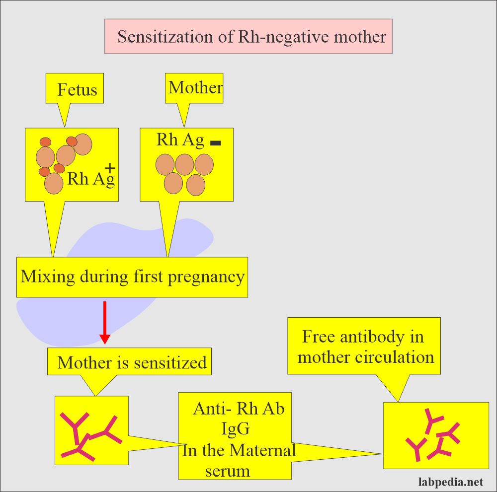 Sensitization of the Rh-negative mother