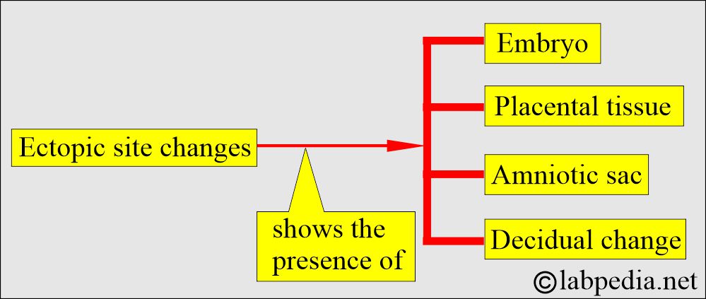 Ectopic sites change Ectopic sites change