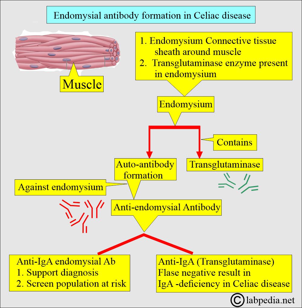 Celiac disease and Sprue: Endomysial antibody and Celiac disease Celiac disease and Sprue: Endomysial antibody and Celiac disease