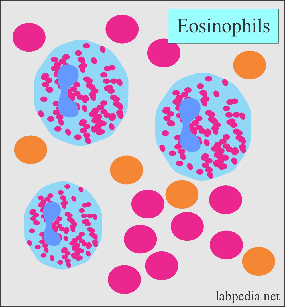 Eosinophils in the peripheral blood smear