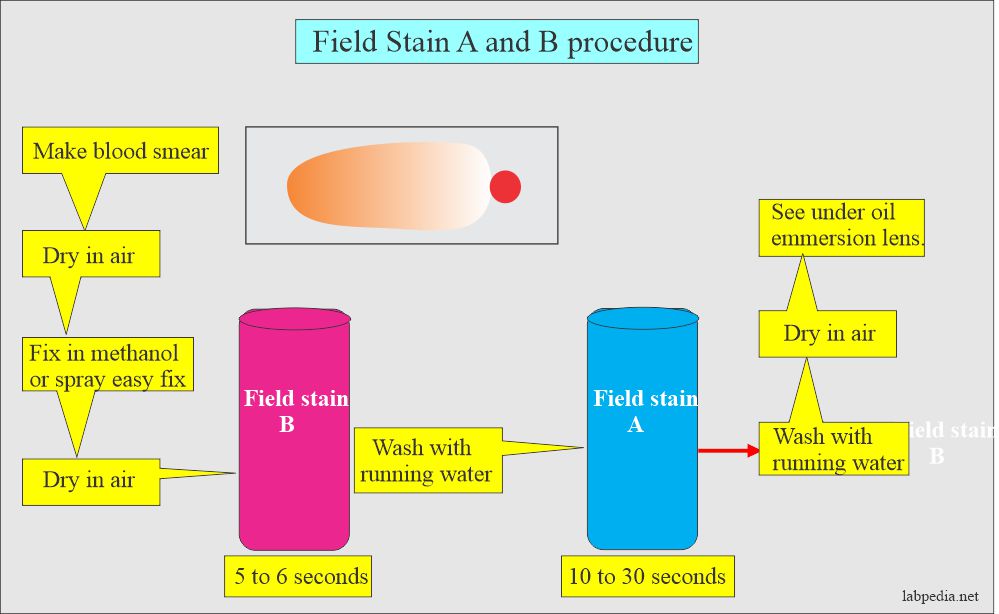 Field stain A and B procedure