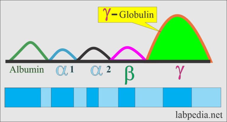 Serum Protein Electrophoresis, Total protein, albumin and globulin ...