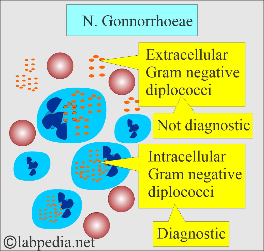 Gonorrhea characteristics Gonorrhea characteristics