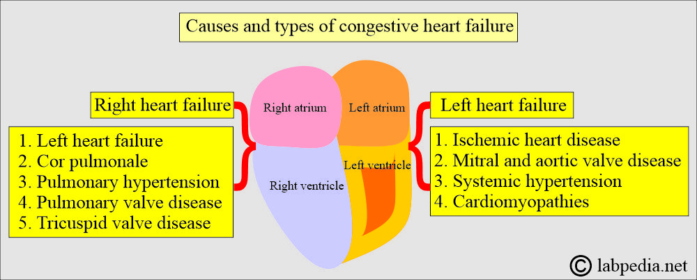 Causes of Heart failure