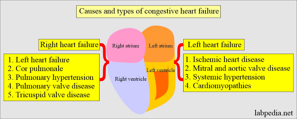 Congestive heart failure types and causes