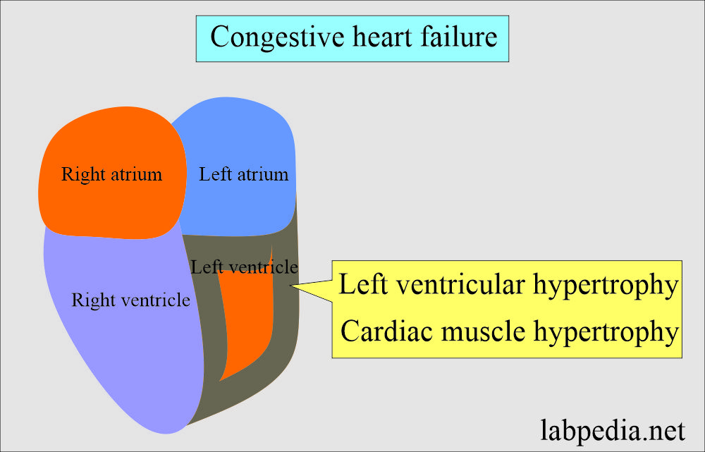 Congestive Heart Failure, Lab Work up