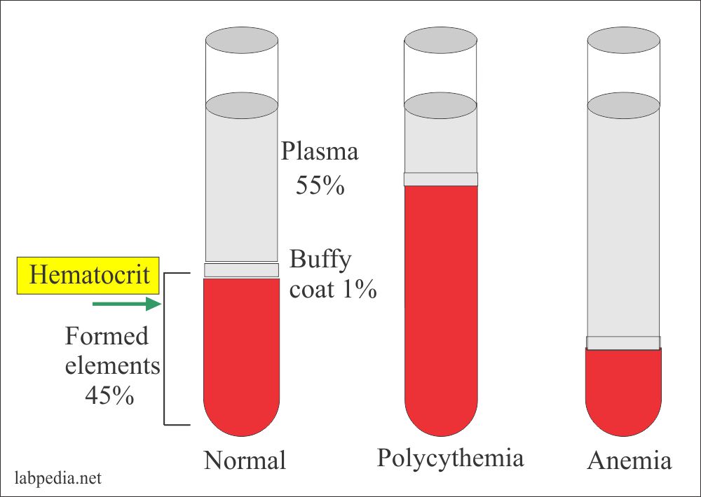 Haemoglobin Part 5 Hematocrit HCT Hct Packed Cell Volume PCV 