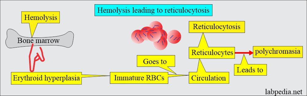 Hemolytic anemia leading to reticulocytosis