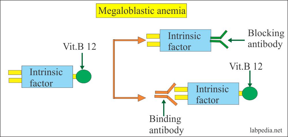 Intrinsic factor Antibody (IF Ab) – Labpedia.net