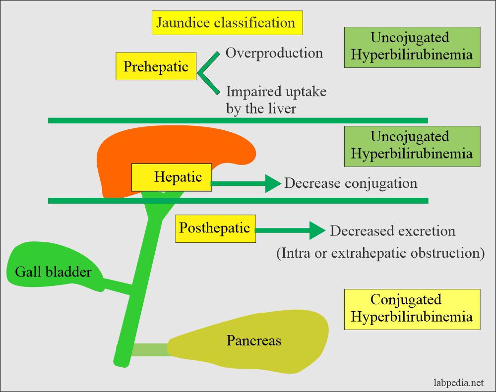 Classification of the jaundice