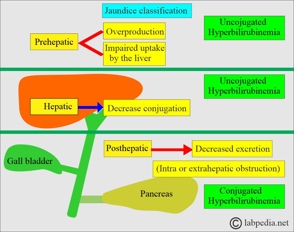 Jaundice classification