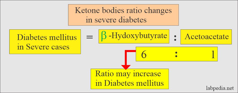 ketone bodies ratio in diabetes mellitus