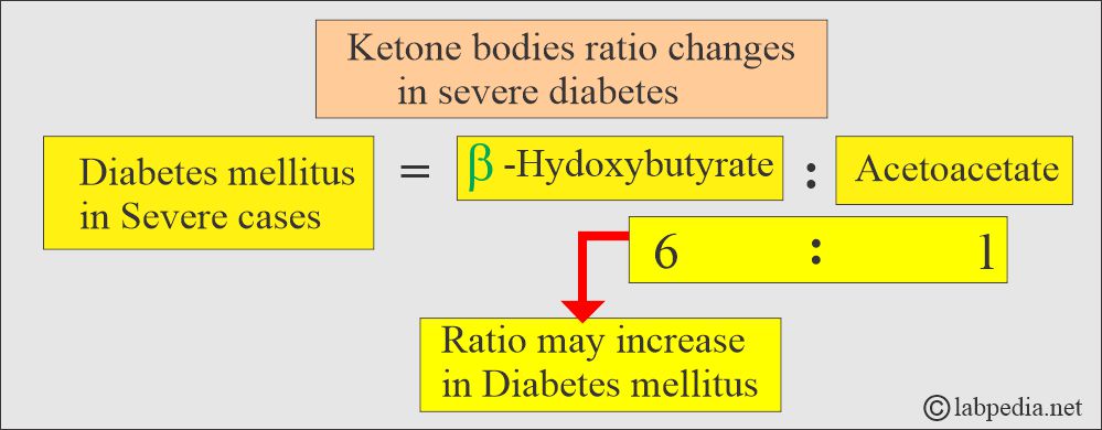ketone bodies ratio in Diabetes Mellitus ketone bodies ratio in Diabetes Mellitus