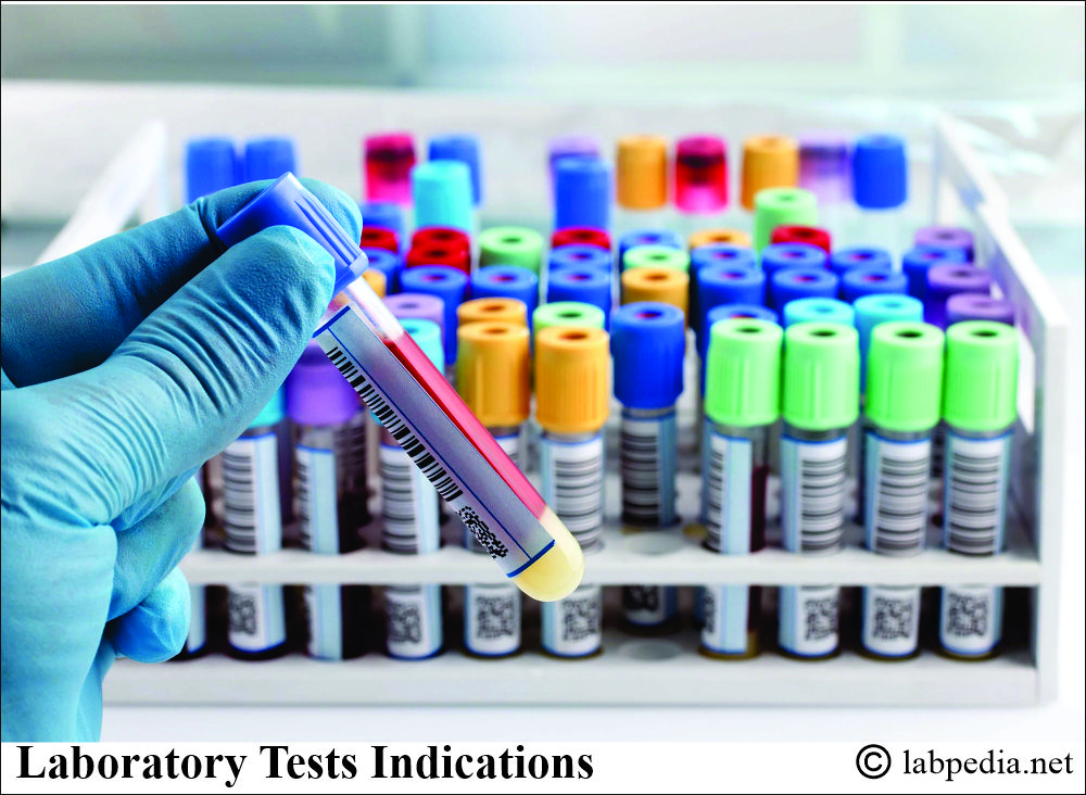 Laboratory tests indications