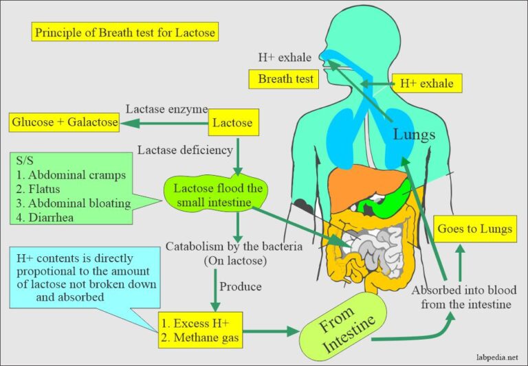 how-to-test-for-lactose-intolerance-in-babies