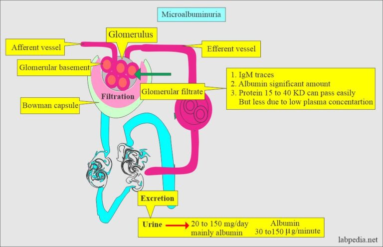 Microalbuminuria - Labpedia.net