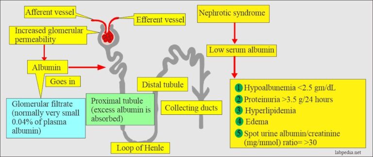 Albumin (Serum Albumin) - Labpedia.net