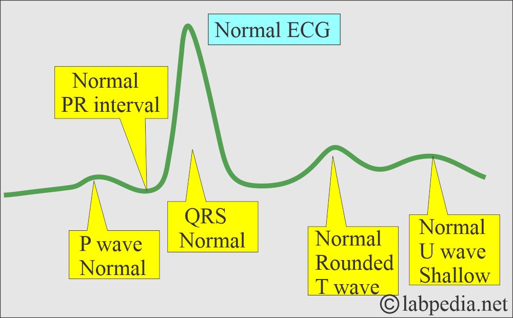 Normal ECG Normal ECG