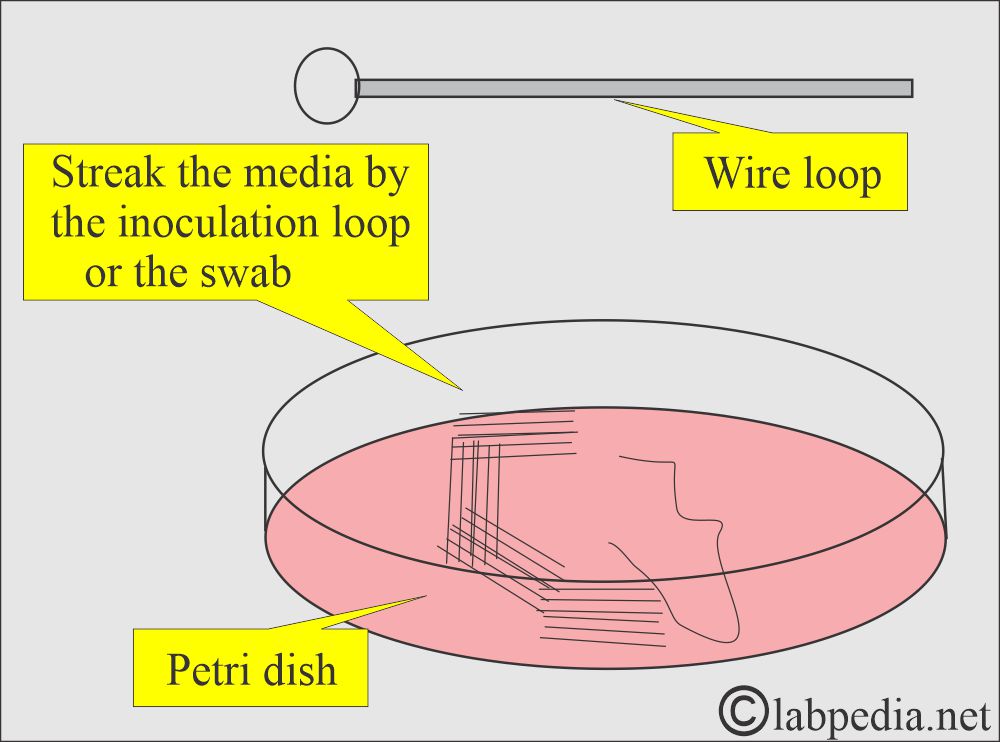Petri dish and inoculation Petri dish and inoculation
