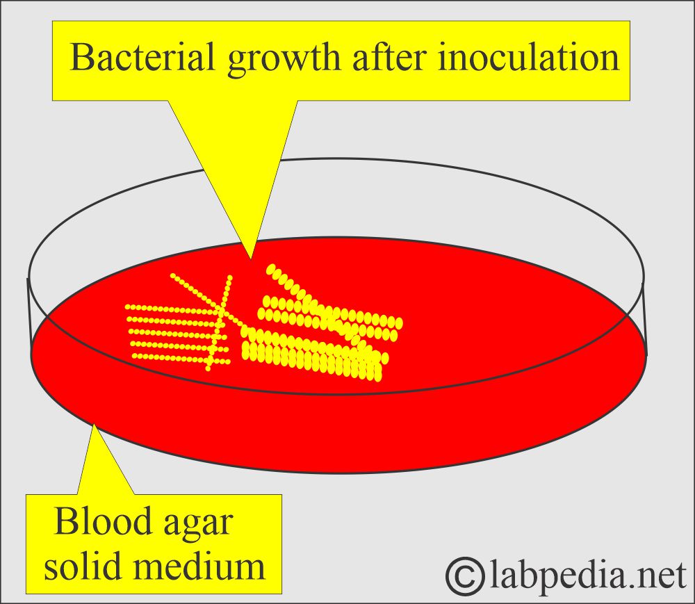 Petri dish and growth after inoculation