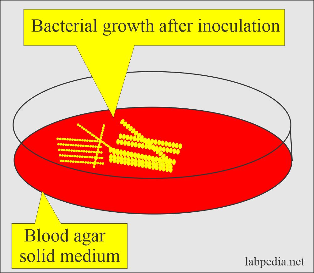 Petri dish with blood agar medium