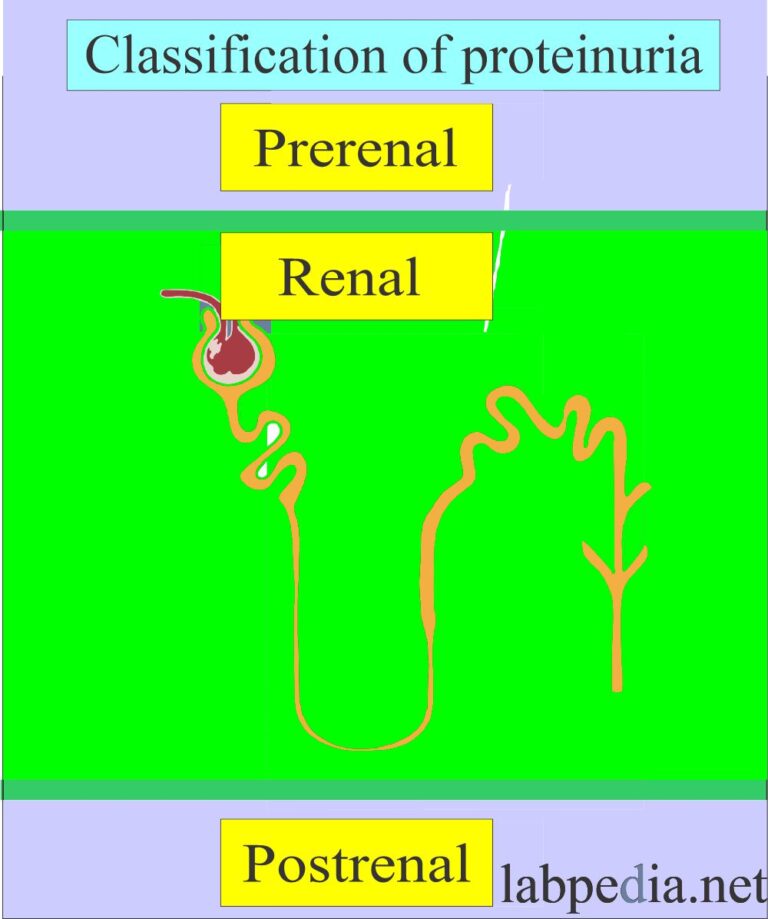 Urine Protein (Proteinuria), Spot Test, Microalbuminuria