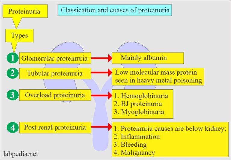 Urine Protein (Proteinuria), Microalbuminuria - Labpedia.net