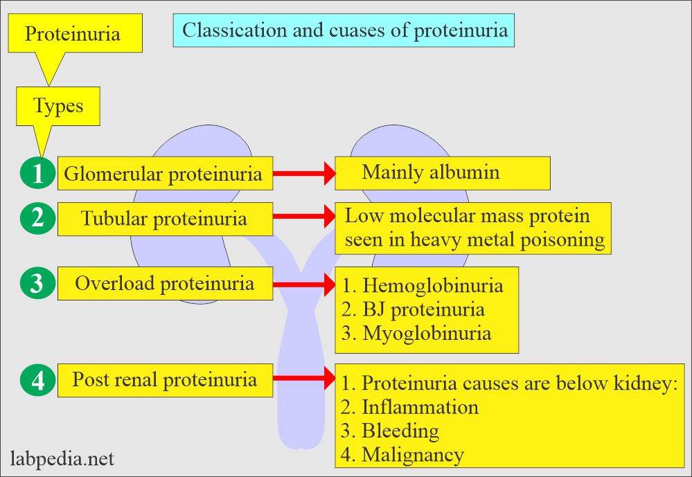 Urine protein: Classification of proteinuria 