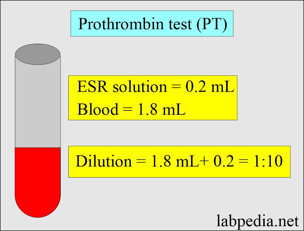 Prothrombin test (PT): Sample for Prothrombin test (PT)
