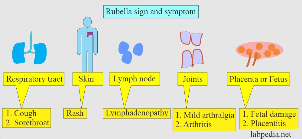 Rubella signs and symptoms