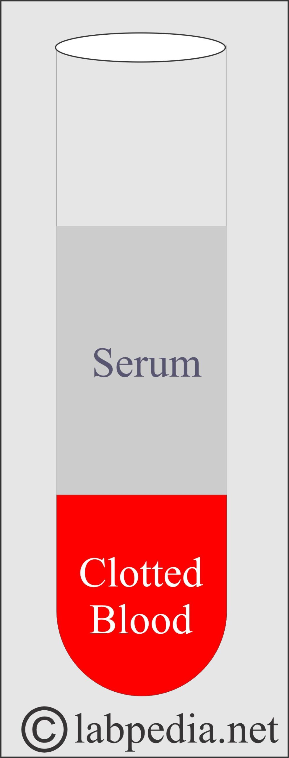 Serum over the clotted blood Serum over the clotted blood
