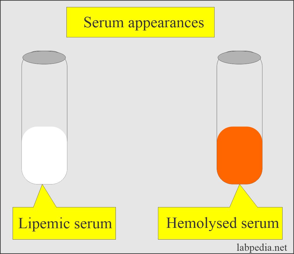 Blood sample That should be Discarded: Serum appearance