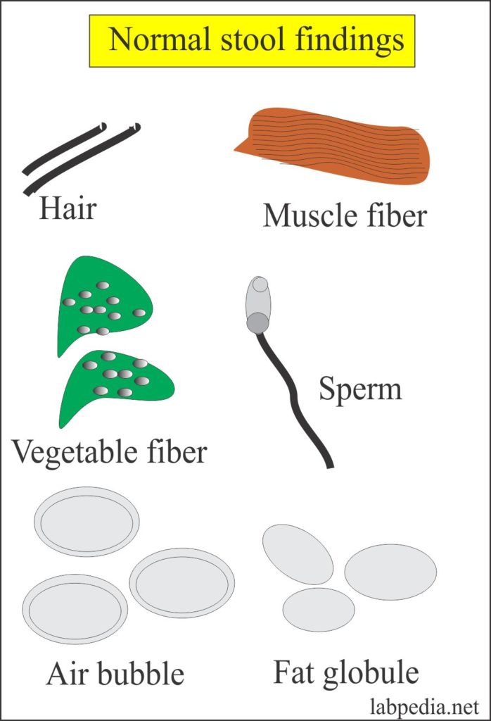 Stool Examination Part 2 Normal Stool Findings