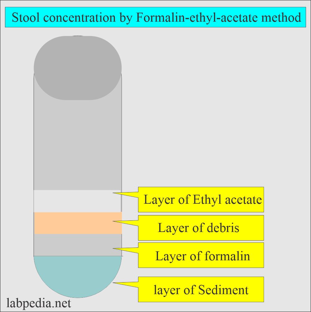 Stool formalin-ethyl acetate method