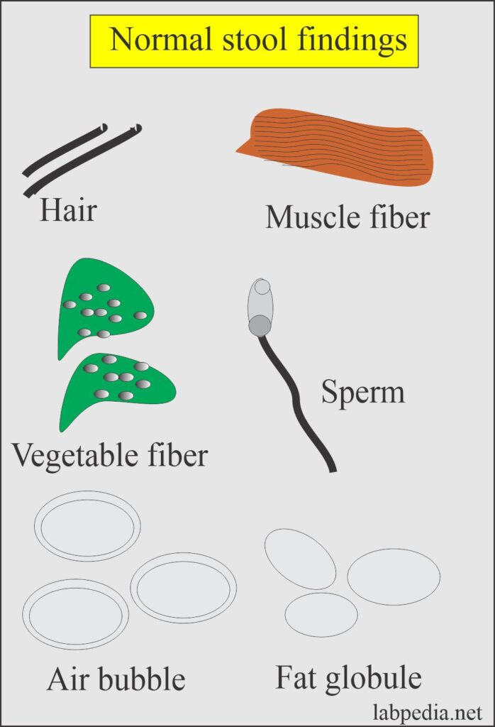 Stool Examination:- Part 1 - Stool Examination and Interpretations ...