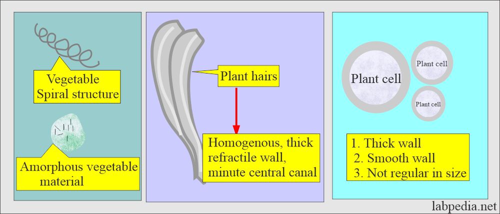 Stool examination: Stoolplant cells, plant, and hairs